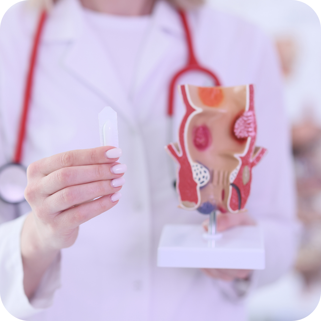 Haemorrhoids treatment in Wales