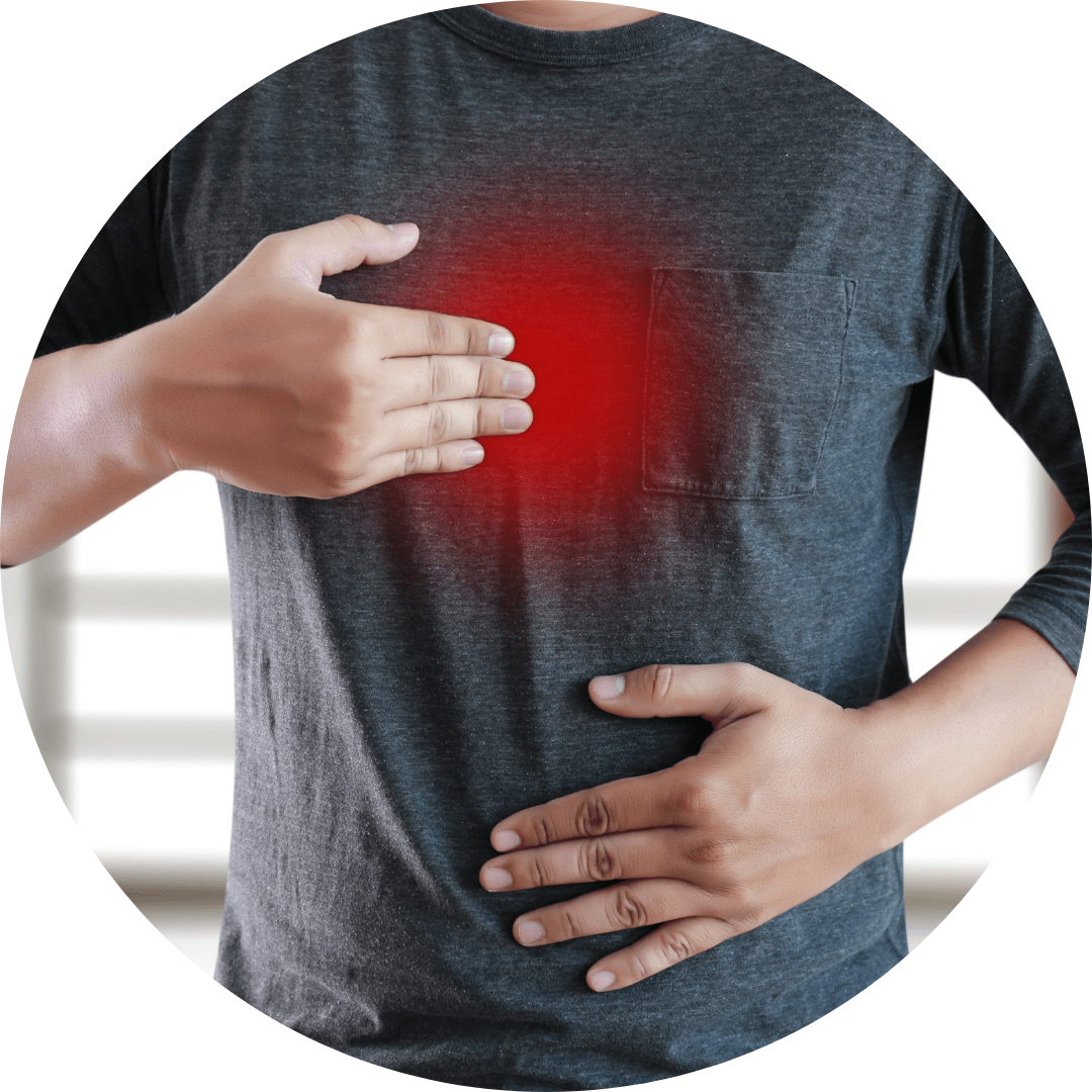 Indigestion and Reflux treatment in Wales