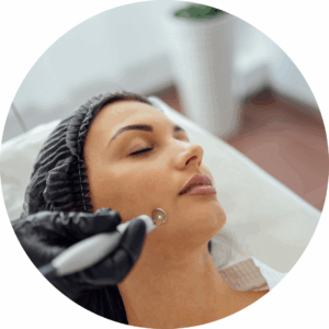 Warts treatment in Wales